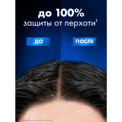 Шампунь против перхоти 400 мл, CLEAR MEN "Ледяная свежесть" 609833 - МСК «Форвард»