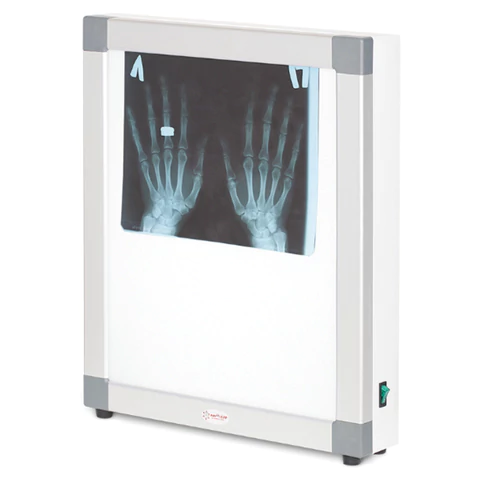 Негатоскоп общего назначения АРМЕД 1-кадровый, размер экрана 395х480 мм, 1726301 631203 - МСК «Форвард»